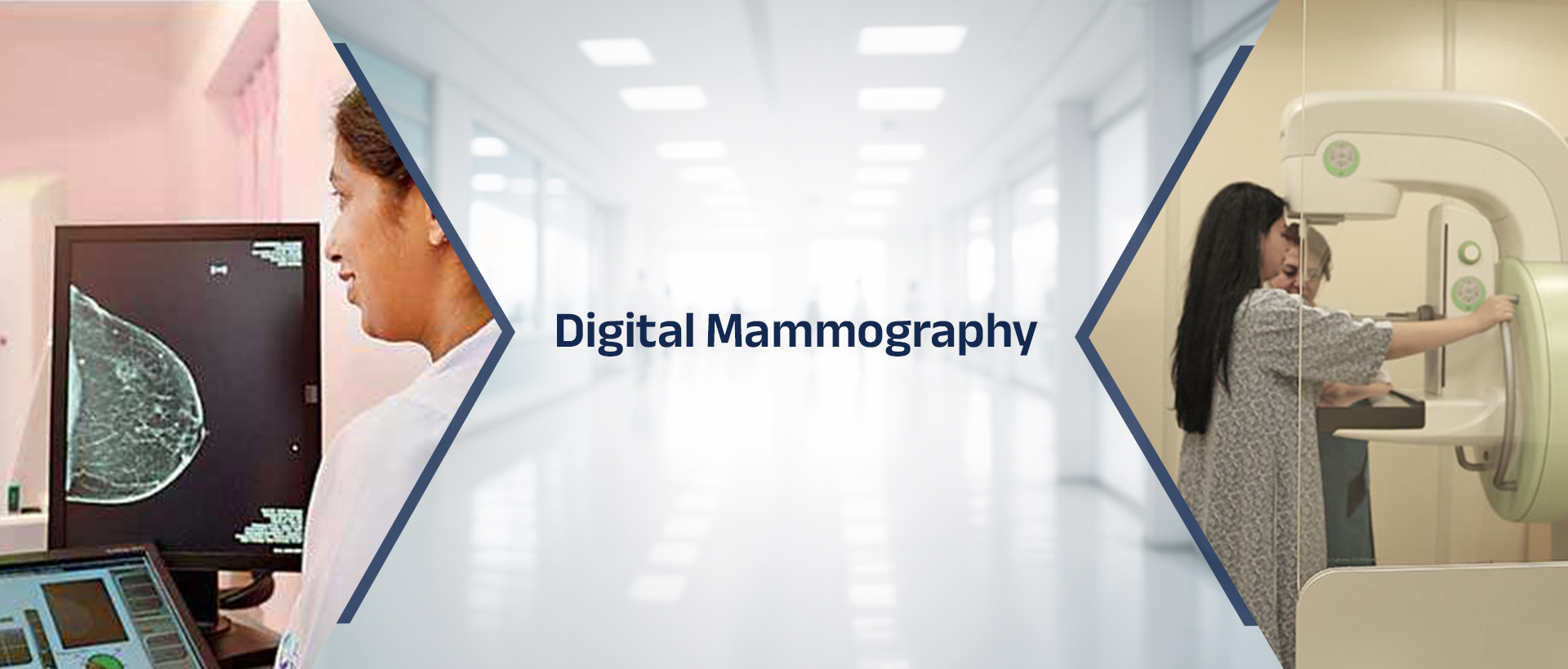 Digital Mammography
